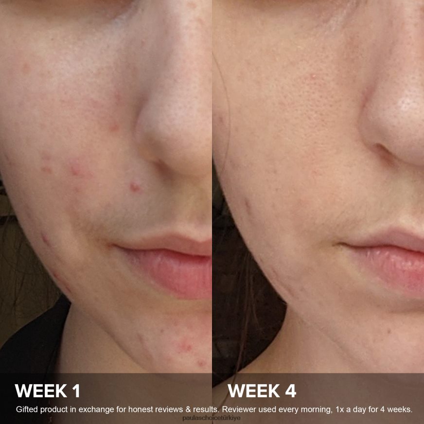 Paula's Choice 02RV6J78 tam dolu c15 süper güçlendirici