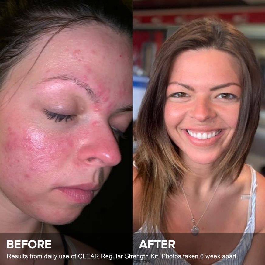 Paula's Choice 02RV6J8 3 adımlı rutin ekstra güç kiti